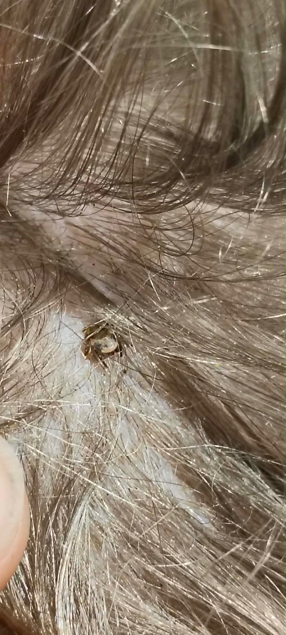 After Introduction - visual overview of condition